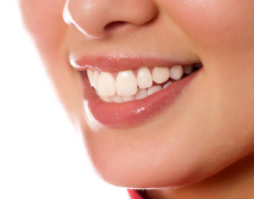 牙齿矫正的方法有哪些?